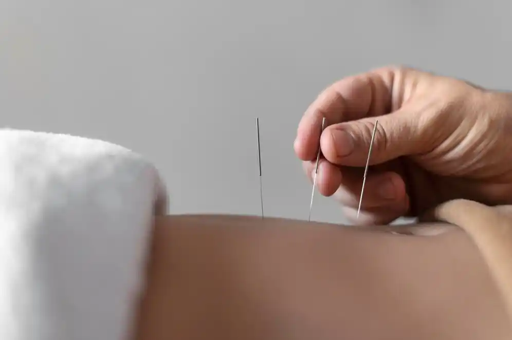 acupuncture for constipation