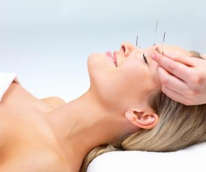 Acupuncture for Cosmetic