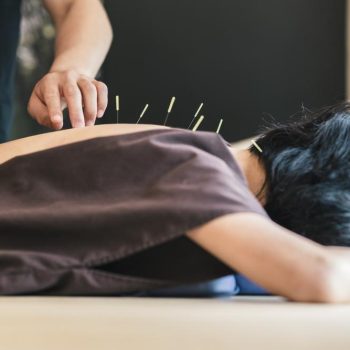 acupuncture Doubleview