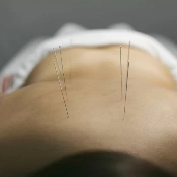 How deep does acupuncture needle go