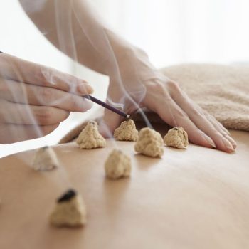 Moxibustion in Acupuncture